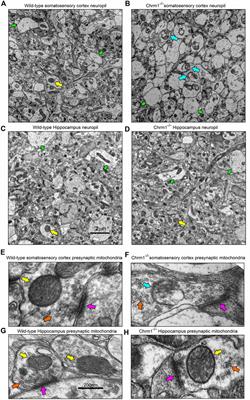 Hippocampal versus cortical deletion of cholinergic receptor muscarinic 1 in mice differentially affects post-translational modifications and supramolecular assembly of respiratory chain-associated proteins, mitochondrial ultrastructure, and respiration: implications in Alzheimer’s disease